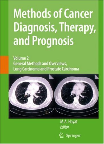 Methods Of Cancer Diagnosis Therapy And Prognosis General Methods And Overviews Lung Carcinoma And Prostate Carcinoma Methods Of Cancer Diagnosis Therapy And Prognosis Volume 2 1st Edition Ma Hayat
