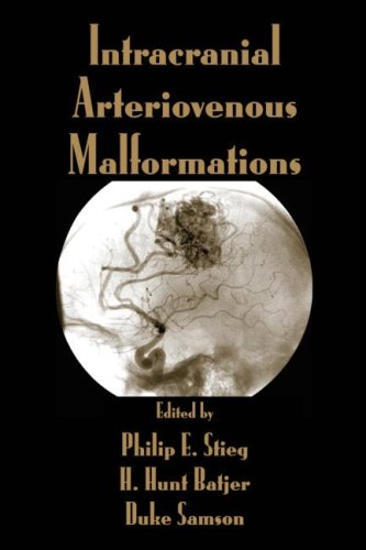 Intracranial Arteriovenous Malformations 1st Edition Philip E Stieg