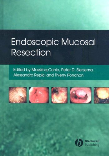 Endoscopic Mucosal Resection 1st Edition Massimo Conio Pieter Siersema