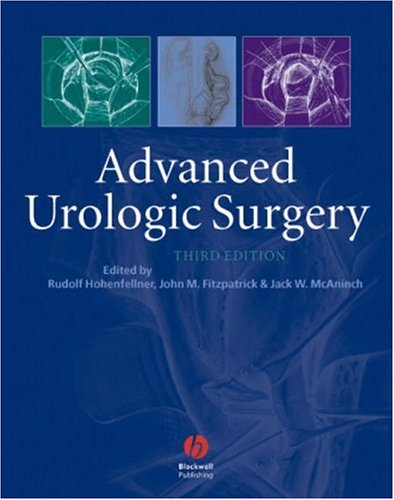 Advanced Urologic Surgery 3rd Edition 3rd Edition Rudolph Hohenfellner
