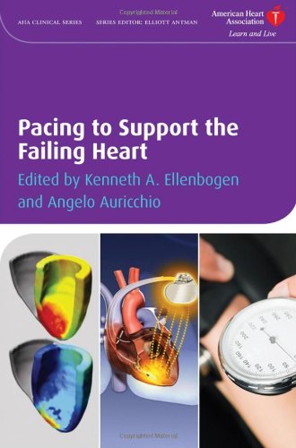 Pacing To Support The Failing Heart American Heart Association Clinical Series 1st Edition Kenneth Ellenbogen