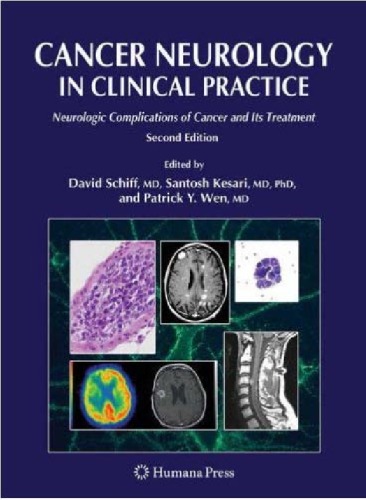Cancer Neurology In Clinical Practice 2nd Edition Neurologic Complications Of Cancer And Its Treatment Current Clinical Oncology David Schiff