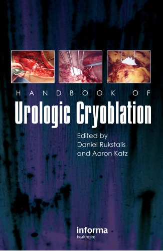Handbook of Urologic Cryoablation 1st Edition by Daniel Rukstalis ISBN 1841845779 9781841845777