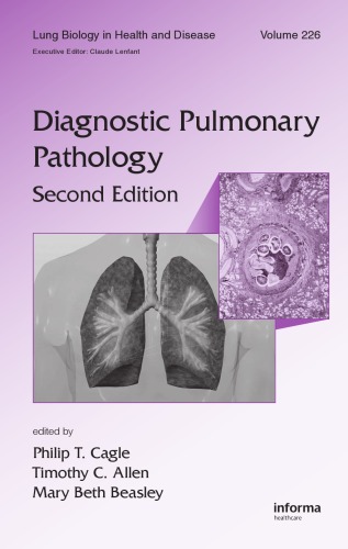 Lung Biology In Health And Disease Volume 226 Diagnostic Pulmonary Pathology 2nd Edition Philip T Cagle
