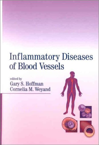 Inflammatory Diseases Of Blood Vessels 1st Gary S Hoffman Cornelia M Weyand
