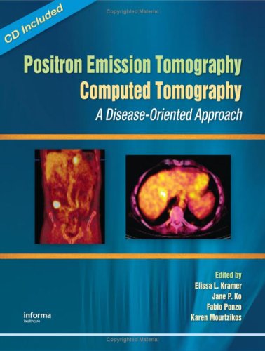 Positron Emission Tomographycomputed Tomography A Diseaseoriented Approach Elissa Kramer