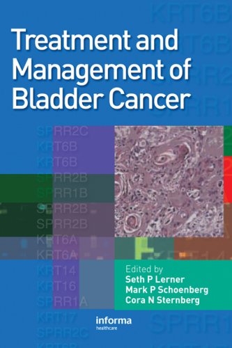 Treatment And Management Of Bladder Cancer 1 Harcdr Seth P Lerner