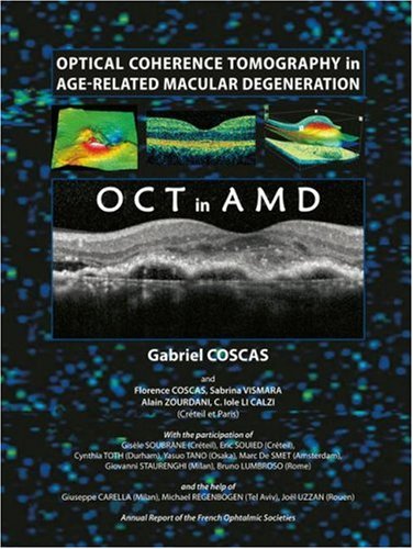 Optical Coherence Tomography In Agerelated Macular Degeneration 1st Edition Gabriel Coscas
