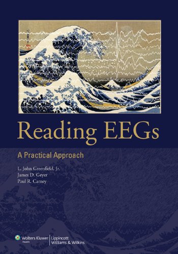 Reading Eegs A Practical Approach 1 Pappsc L John Greenfield