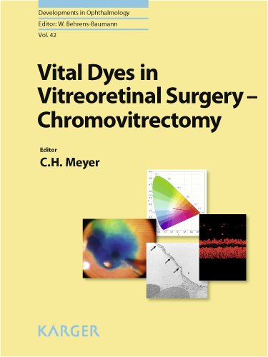 Vital Dyes In Vitreoretinal Surgery Chromovitrectomy Developments In Ophthalmology Vol 42 1st Edition Carsten H Meyer
