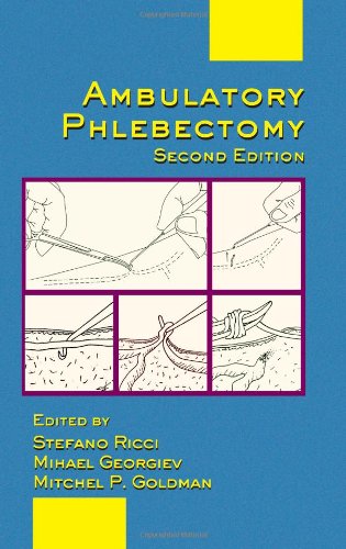 Ambulatory Phlebectomy Second Edition Basic And Clinical Dermatology 2nd Mitchel P Goldman