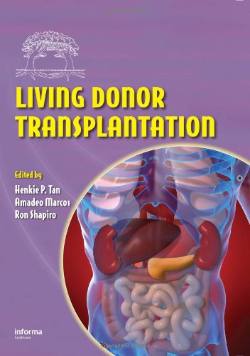 Living Donor Transplantation 1st Edition Henkie P Tan Amadeo Marcos