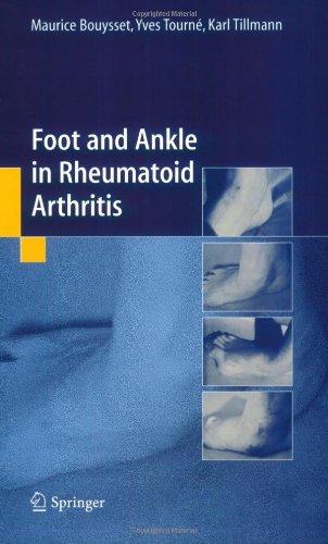Foot And Ankle In Rheumatoid Arthritis 1st Edition Maurice Bouysset