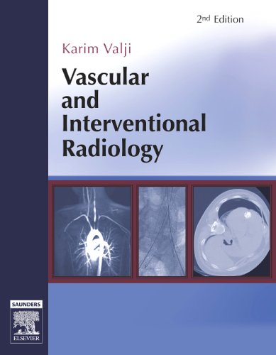 Vascular And Interventional Radiology 2 Edition 2nd Edition Karim Valji