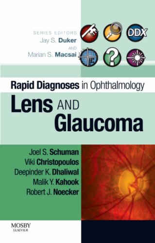 Rapid Diagnosis In Ophthalmology Series Lens And Glaucoma 1st Edition Joel S Schuman