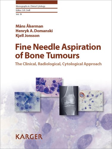 Fine Needle Aspiration Of Bone Tumours The Clinical Radiological Cytological Approach Monographs In Clinical Cytology Vol 19 1st Edition M Akerman