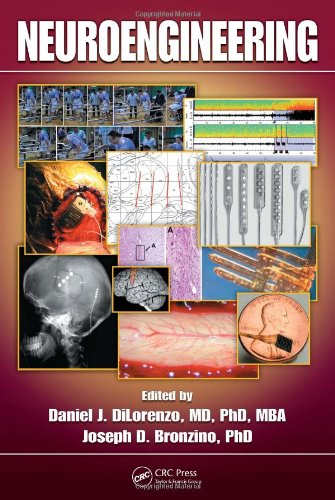 Neuroengineering 1st Edition Daniel J Dilorenzo Joseph D Bronzino