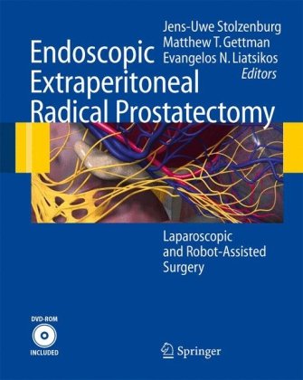 Endoscopic Extraperitoneal Radical Prostatectomy Laparoscopic And Robotassisted Surgery 1st Edition Jensuwe Stolzenburg Editor