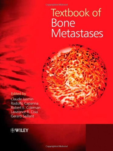 Textbook Of Bone Metastases 1st Edition Claude Jasmin Rodolfo Capanna
