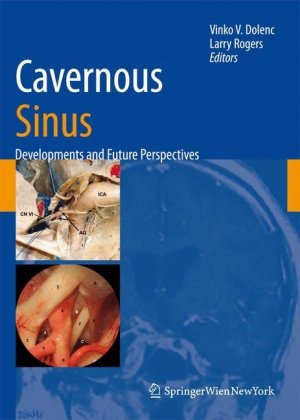 Cavernous Sinus Developments And Future Perspectives 1st Edition Vinko V Dolenc