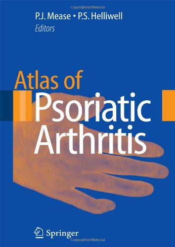 Atlas Of Psoriatic Arthritis 1st Edition Philip J Mease Philip S Helliwell