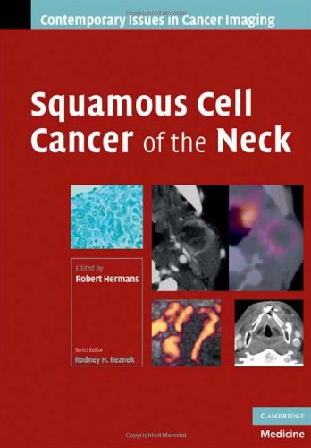 Squamous Cell Cancer Of The Neck Contemporary Issues In Cancer Imaging 1st Edition Robert Hermans
