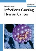 Infections Causing Human Cancer 1st Edition Harald Zur Hausen