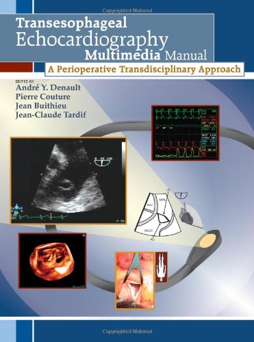 Transesophageal Echocardiography Multimedia Manual A Perioperative Transdisciplinary Approach Andre Y Denault