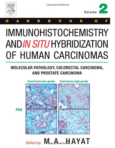 Handbook Of Immunohistochemistry And In Situ Hybridization Of Human Carcinomas Volume 2 Molecular Pathology Colorectal Carcinoma And Prostate Carcinoma 1st Edition M A Hayat