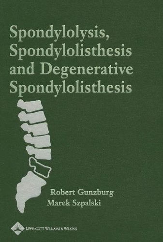 Spondylolysis Spondylolisthesis And Degenerative Spondylolisthesis 1st Edition Robert Gunzburg