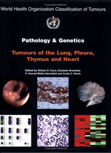 Pathology And Genetics Of Tumours Of The Lung Pleura Thymus And Heart World Health Organization Classification Of Tumours 1st Edition Iarc