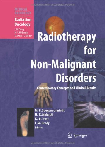 Radiotherapy For Nonmalignant Disorders Contemporary Concepts And Clinical Results Medical Radiology Radiation Oncology 1st Edition Lw Brady