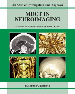 Multidetector Ct In Neuroimaging An Atlas And Practical Guide 1st Edition Evelyn M Teasdale