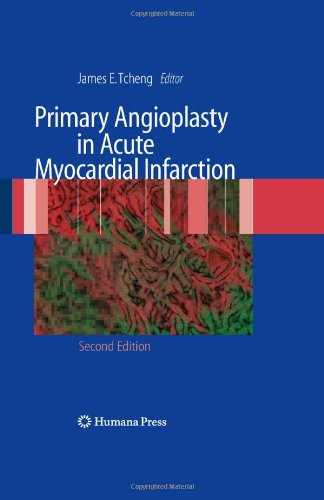 Primary Angioplasty In Acute Myocardial Infarction Second Edition 2nd Edition Warren J Cantor Auth
