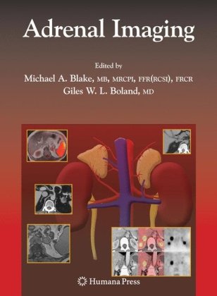 Adrenal Imaging 1st Edition Shamlal Mangray Ronald A Delellis Auth