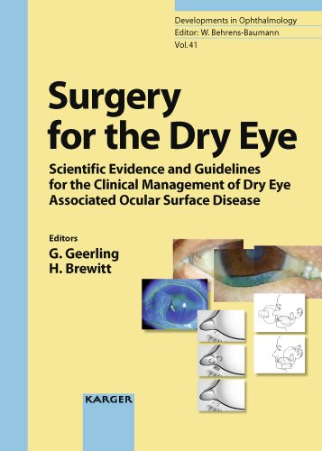 Surgery For The Dry Eye Scientific Evidence And Guidelines For The Clinical Management Of Dry Eye Associated Ocular Surface Disease 1st Edition Gerd Geerling