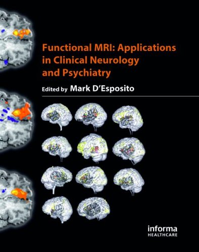 Functional Mri Applications In Clinical Neurology And Psychiatry 1st Edition Mark Desposito