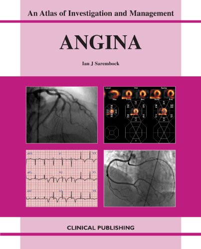 Angina An Atlas Of Investigation And Management 1st Edition Ian J Sarembock