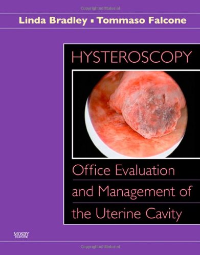 Hysteroscopy Office Evaluation And Management Of The Uterine Cavity 1 Harcdr Linda D Bradley Md
