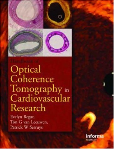 Optical Coherence Tomography In Cardiovascular Research 1st Edition Evelyn Regar