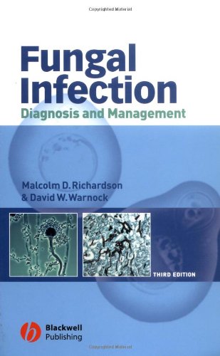 Fungal Infection Diagnosis And Management 2003 3rd Edition Malcolm Richardson