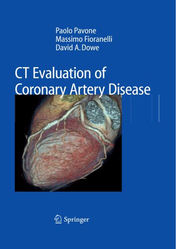 Ct Evaluation Of Coronary Artery Disease 1st Edition Paolo Pavone