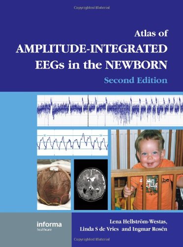 An Atlas Of Amplitudeintegrated Eegs In The Newborn 2nd Edition Encyclopedia Of Visual Medicine Series 2nd Edition Lena Hellstrmwestas
