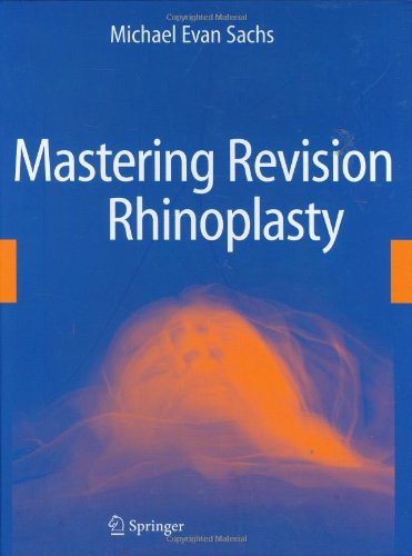 Mastering Revision Rhinoplasty 1st Edition Michael Evan Sachs