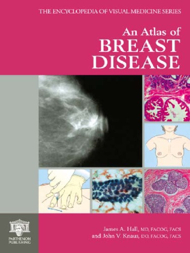 An Atlas Of Breast Disease The Encyclopedia Of Visual Medicine James A Hall