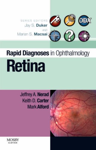 Rapid Diagnosis In Ophthalmology Series Retina 1st Edition Adam H Rogers