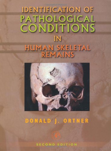 Identification Of Pathological Conditions In Human Skeletal Remains Second Edition 2nd Edition Donald J Ortner