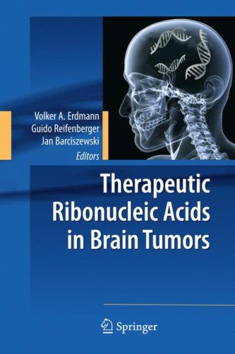 Therapeutic Ribonucleic Acids In Brain Tumors 1st Edition Cristbal Beldainiesta