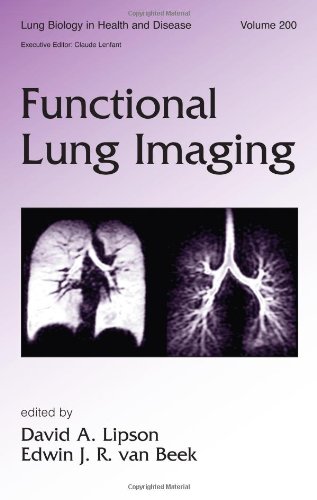 Lung Biology In Health Disease Volume 200 Functional Lung Imaging 1st Edition David Lipson