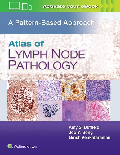 Atlas Of Lymph Node Pathology A Pattern Based Approach 1st Edition Amy S Duffield Md